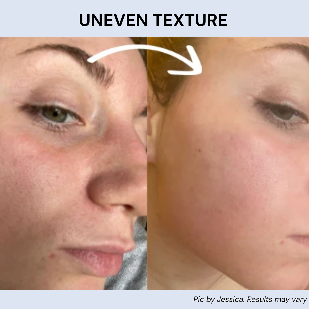 Radiant™ Skin Enhancement