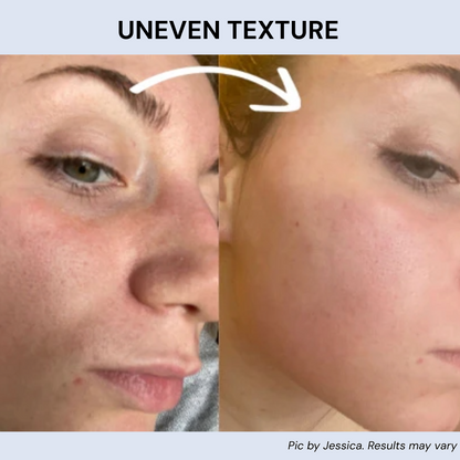 Radiant™ Skin Enhancement